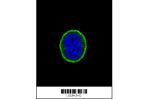 Confocal immunofluorescent analysis of IL10RA Antibody with MCF-7 cell followed by Alexa Fluor 488-conjugated goat anti-rabbit lgG (green). (IL-10RA anticorps  (AA 147-175))