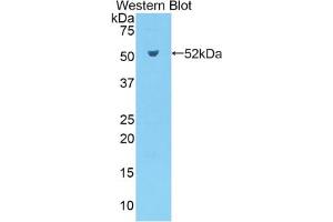 Western blot analysis of the recombinant protein. (Kallikrein 7 anticorps  (AA 30-249))