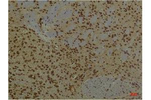 Immunohistochemistry (IHC) analysis of paraffin-embedded Mouse Brain Tissue using PI3 Kinase P85 alpha Mouse Monoclonal Antibody diluted at 1:200. (PIK3R1 anticorps)