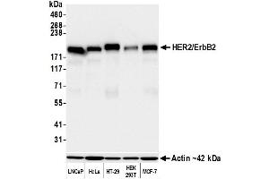 Western Blotting (WB) image for anti-Receptor tyrosine-protein kinase erbB-2 (ErbB2/Her2) (AA 1205-1255) antibody (ABIN7455181) (Recombinant ErbB2/Her2 anticorps  (AA 1205-1255))