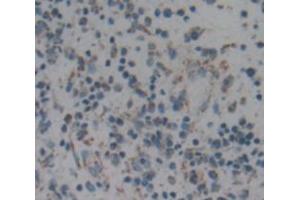 Used in DAB staining on fromalin fixed paraffin- embedded liver cancer tissue (ARPC2 anticorps  (AA 1-300))