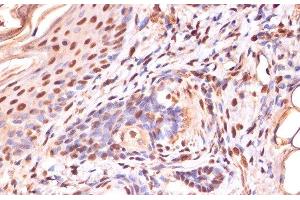Immunohistochemistry of paraffin-embedded Human skin using Phospho-β-catenin(S33/S37/T41) Polyclonal Antibody at dilution of 1:100 (40x lens).