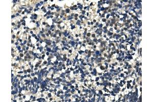 IHC analysis of ULK1 using anti-ULK1 antibody (ABIN7602755). (ULK1 anticorps  (C-Term))