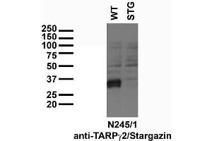Immunoblot versus low-speed pellet samples from wild-type (WT) and Stargazer mutant (STG) mice and probed with N245/1 TC supe.