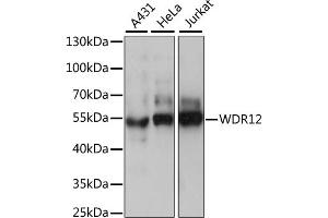 Western blot analysis of extracts of various cell lines, using WDR12 antibody (ABIN7271353) at 1:1000 dilution. (WDR12 anticorps  (AA 1-280))