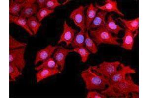 Immunofluorescence (IF) image for anti-Keratin 1 (KRT1) antibody (ABIN2664915) (Cytokeratin 1 anticorps)