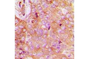 anti-Family with Sequence Similarity 84, Member B (FAM84B) (N-Term) antibody