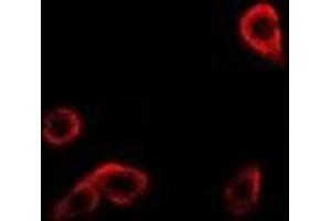 Immunofluorescent analysis of RRM1 staining in Hela cells.