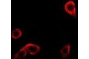 Immunofluorescent analysis of RRM1 staining in Hela cells. (RRM1 anticorps)