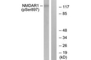 Western blot analysis of extracts from LOVO cells, using NMDAR1 (Phospho-Ser897) Antibody. (GRIN1/NMDAR1 anticorps  (pSer897))