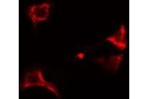 ABIN6274949 staining A549  cells by IF/ICC. (CLIP3 anticorps  (Internal Region))