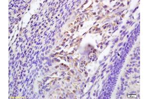 Formalin-fixed and paraffin embedded mouse embryo labeled with Rabbit Anti Galectin 3 Polyclonal Antibody, Unconjugated (ABIN672321) at 1:200 followed by conjugation to the secondary antibody and DAB staining