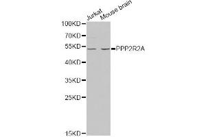 Western blot analysis of extracts of various cell lines, using PPP2R2A antibody. (PPP2R2A anticorps)