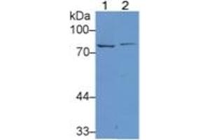 Rabbit Detection antibody from the kit in WB with Positive Control: Sample Lane1: Rat Uterus lysate; Lane2: Rat Lung lysate.