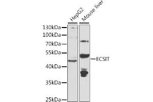 Western blot analysis of extracts of various cell lines, using ECSIT antibody (ABIN6130352, ABIN6139923, ABIN6139924 and ABIN6223767) at 1:1000 dilution.
