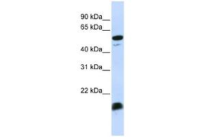 WB Suggested Anti-C4BPA Antibody Titration:  0. (C4BPA anticorps  (Middle Region))