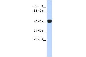 WB Suggested Anti-TRIOBP Antibody Titration:  0. (TRIOBP anticorps  (Middle Region))