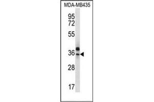 Western blot analysis of OR51Q1 Antibody (N-term) in MDA-MB435 cell line lysates (35ug/lane).