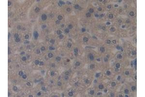 Detection of MUC1 in Mouse Liver Tissue using Polyclonal Antibody to Mucin 1 (MUC1) (MUC1 anticorps  (AA 474-630))