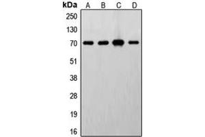 Western blot analysis of S6K1 expression in MCF7 (A), HeLa (B), MDCK (C), mouse brain (D) whole cell lysates. (RPS6KB1 anticorps  (C-Term))