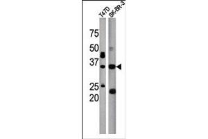 Image no. 1 for anti-Isoprenylcysteine Carboxyl Methyltransferase (ICMT) (C-Term) antibody (ABIN357792) (ICMT anticorps  (C-Term))