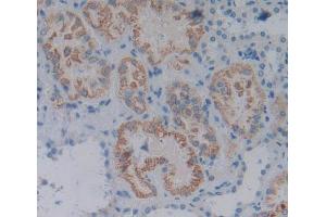 Used in DAB staining on fromalin fixed paraffin- embedded Kidney tissue