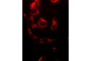 Immunofluorescent analysis of NDUFV1 staining in A549 cells.