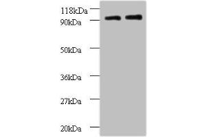 Western blot All lanes: RPS12 antibody at 2 μg/mL Lane 1: EC109 whole cell lysate Lane 2: 293T whole cell lysate Secondary Goat polyclonal to rabbit IgG at 1/15000 dilution Predicted band size: 15 kDa Observed band size: 90 kDa (RPS12 anticorps  (AA 1-132))