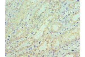 Immunohistochemistry of paraffin-embedded human kidney tissue using ABIN7169843 at dilution of 1:100 (SGTA anticorps  (AA 1-120))