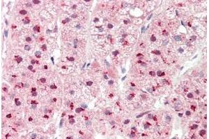 Human Adrenal: Formalin-Fixed, Paraffin-Embedded (FFPE)