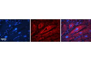 Rabbit Anti-SLC26A3 Antibody  Catalog Number: ARP31608_P050 Formalin Fixed Paraffin Embedded Tissue: Human Adult heart  Observed Staining: Membrane Primary Antibody Concentration: 1:100 Secondary Antibody: Donkey anti-Rabbit-Cy2/3 Secondary Antibody Concentration: 1:200 Magnification: 20X Exposure Time: 0.