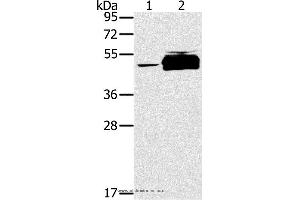 Western blot analysis of K562 cell and human testis tissue, using PTPN20B Polyclonal Antibody at dilution of 1:200 (PTPN20 anticorps)