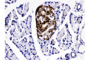 IHC analysis of ATP citrate lyase using anti- ATP citrate lyase antibody .