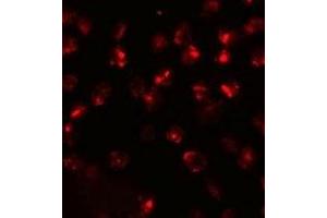 Immunofluorescencent staining of 3T3 cells with ATP2C2 polyclonal antibody  at 20 ug/mL. (ATP2C2 anticorps  (N-Term))