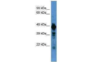 Western Blotting (WB) image for anti-Solute Carrier Family 18 (Vesicular Monoamine Transporter), Member 1 (SLC18A1) (N-Term) antibody (ABIN2787540) (SLC18A1 anticorps  (N-Term))