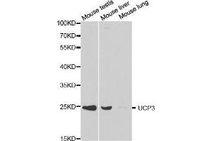 Western blot analysis of extracts of various cell lines, using UCP3 antibody. (UCP3 anticorps  (AA 1-110))