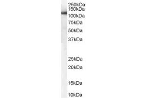 Image no. 1 for anti-USO1 Homolog, Vesicle Docking Protein (USO1) (C-Term) antibody (ABIN374624) (USO1 anticorps  (C-Term))