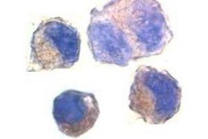 Immunocytochemistry staining of K562 cells using AP30017PU-N ADAM10 antibody at 2 μg/ml.