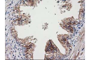 Immunohistochemical staining of paraffin-embedded Human prostate tissue using anti-CDCP1 mouse monoclonal antibody. (CDCP1 anticorps)