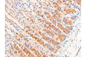 ABIN6267067 at 1/100 staining rat gastric tissue sections by IHC-P.