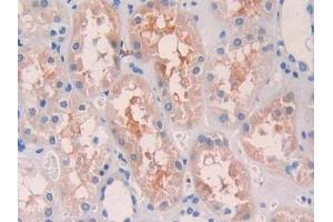 Detection of TERF1 in Human Kidney Tissue using Polyclonal Antibody to Telomeric Repeat Binding Factor 1 (TERF1)