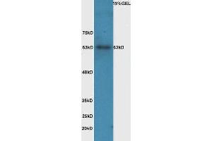 Lane 1: mouse intestinal lysate probed with Rabbit Anti-IL-1R1(Tyr496) Polyclonal Antibody, Unconjugated  at 1:5000 for 90 min at 37˚C. (IL1R1 anticorps  (pTyr496))