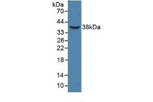 Detection of Recombinant HPR, Human using Polyclonal Antibody to Haptoglobin Related Protein (HPR)