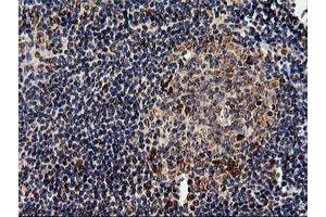 Image no. 3 for anti-EPM2A (Laforin) Interacting Protein 1 (EPM2AIP1) antibody (ABIN1498046) (EPM2AIP1 anticorps)