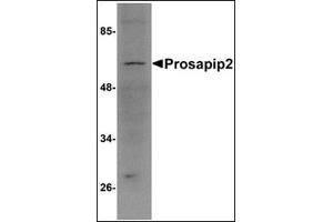 Western blot analysis of Prosapip2 in rat liver tissue lysate with this product at 1 μg/ml. (TBKBP1 anticorps  (C-Term))