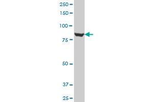 IMMT polyclonal antibody (A01), Lot # 060503JCS1 Western Blot analysis of IMMT expression in A-431 .