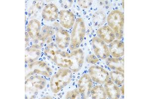 Immunohistochemistry of paraffin-embedded rat kidney using INHBC antibody (ABIN5975306) at dilution of 1/100 (40x lens). (INHBC anticorps)