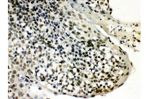 Anti- SNRPN Picoband antibody, IHC(P) IHC(P): Human Tonsil Tissue