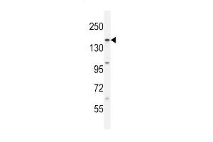 BCORL1 Antibody (N-term) (ABIN654801 and ABIN2844476) western blot analysis in HL-60 cell line lysates (35 μg/lane).