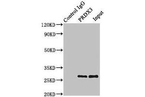 Immunoprecipitating PRDX3 in Hela whole cell lysate Lane 1: Rabbit control IgG instead of ABIN7172023 in Hela whole cell lysate.
